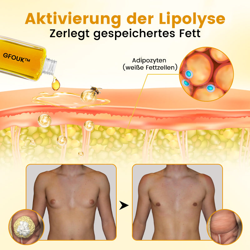 🔥GFOUK™ ThermoFirm Bee Venom Oil for the treatment of gynecomastia