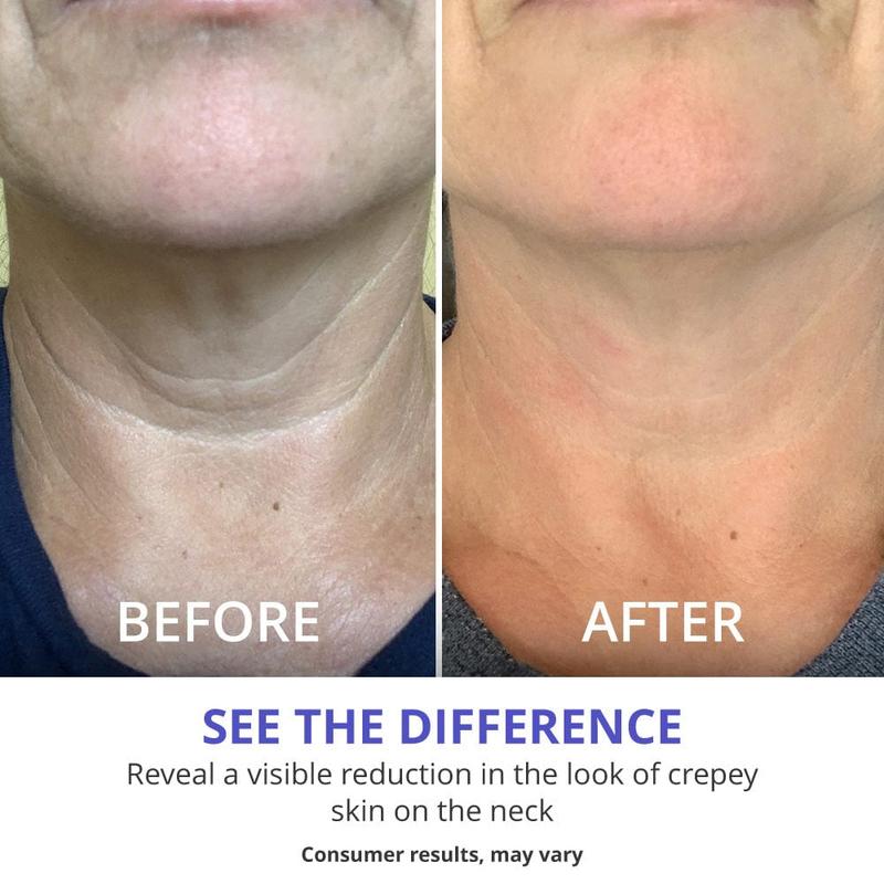 GOPURE Neck Cream – Firming & Tightening Neck Cream for Sagging Skin