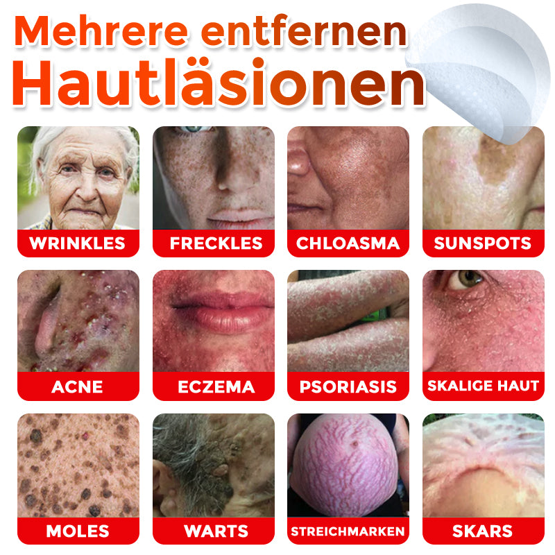 GFOUK® Microneedling Botanical Skin Tag Removal Patch 🇩🇪 Made in Germany