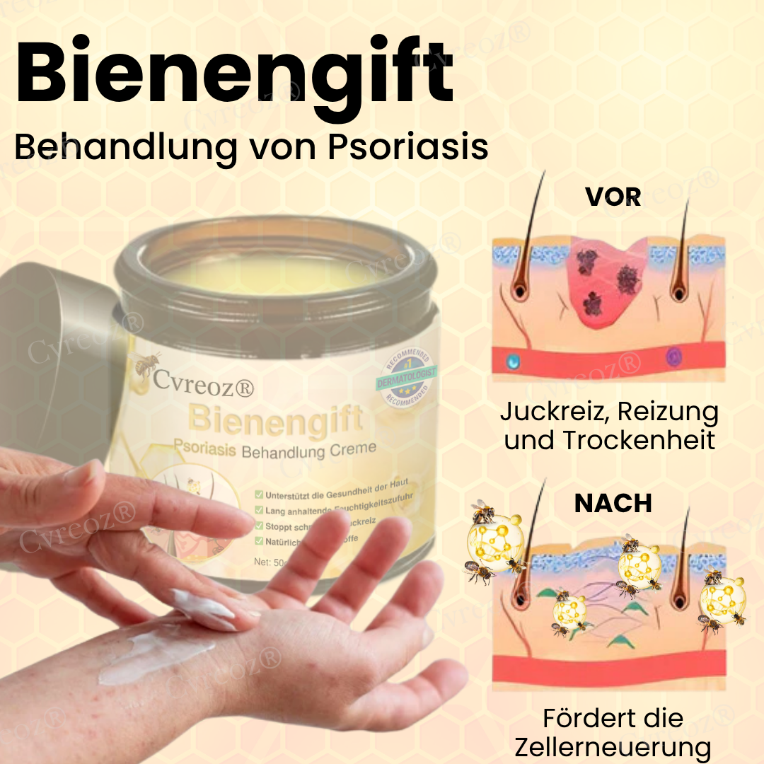 Cvreoz® Bee Venom Psoriasis Treatment Cream