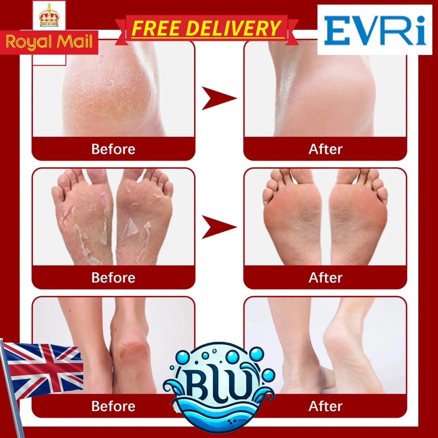 Natural Honey+VitE Foot Care, Kills Athlete's Foot, Removes Dead Skin Cells and Makes Feet as Soft as Baby Feet