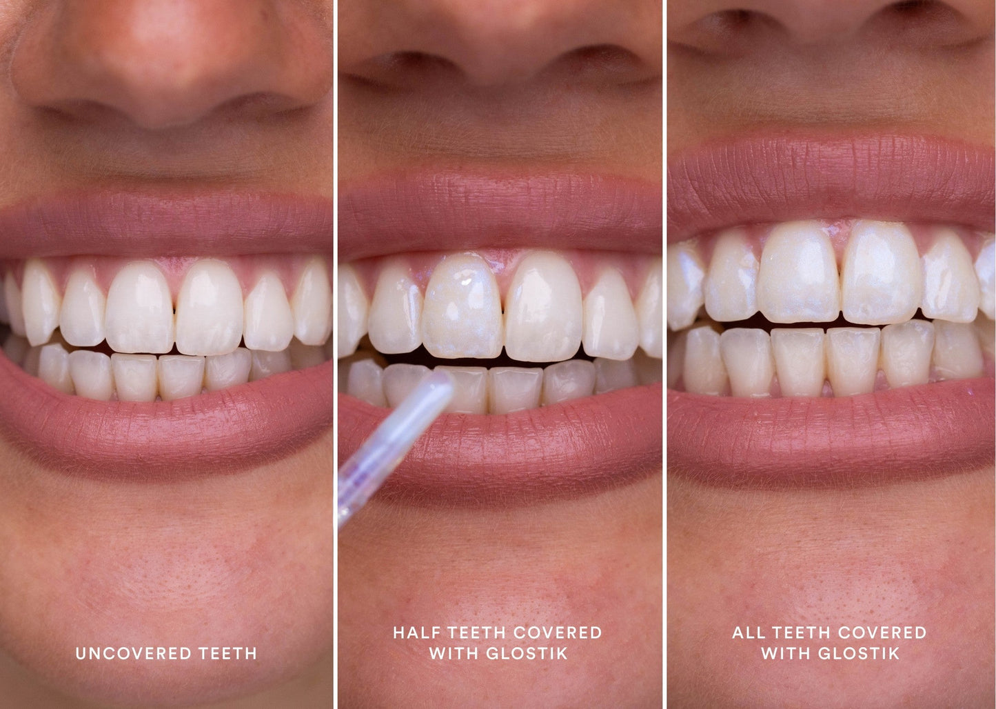 🔥Now 40% off🎁 - Glostik PAP+ Tooth Gloss range – 🦷Bright white teeth in minutes! 🌿Natural &amp; effective - Perfect smile with shine, a tooth gloss revolution for you. 