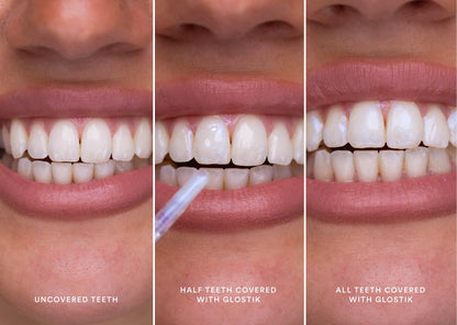 🔥Now 40% off🎁 - Glostik PAP+ Tooth Gloss range – 🦷Bright white teeth in minutes! 🌿Natural &amp; effective - Perfect smile with shine, a tooth gloss revolution for you. 
