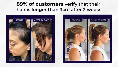 🌿LAST DAY OFFER – 50% OFF🌿 HZA™ Natural Hair Growth Spray 