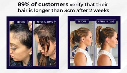 🌿LAST DAY OFFER – 50% OFF🌿 HZA™ Natural Hair Growth Spray 