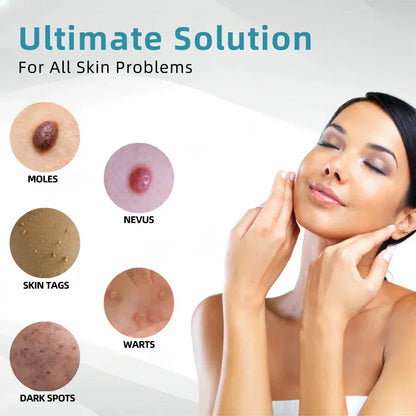 🛡️Dougparmo® VelvetSkin+ Integrated laser eraser ⚔︎(⚡powered by CO₂ laser technology - effectively removes moles, warts, skin labels, pigmentation spots and other skin defects)