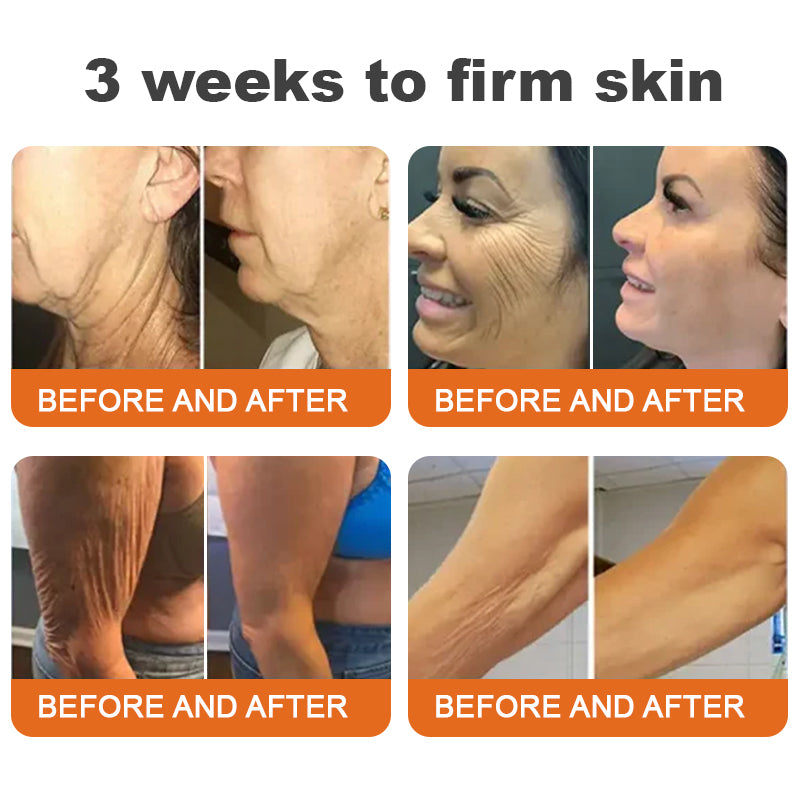 🐝💖Flysmus™ Botox Bee Venom Firming Serum Stick – (Made and shipped in Germany) – LAST DAY 70% OFF