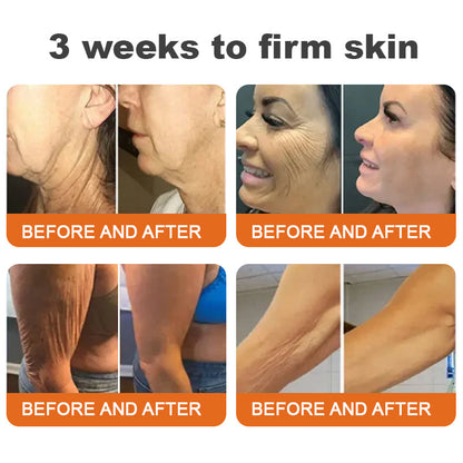 🐝💖Flysmus™ Botox Bee Venom Firming Serum Stick – (Made and shipped in Germany) – LAST DAY 70% OFF