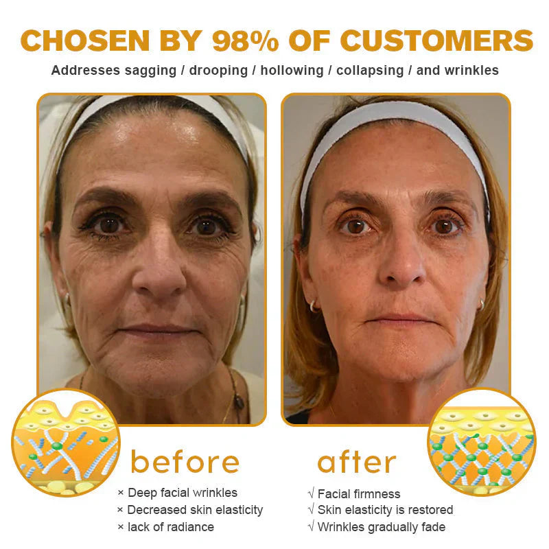 👨‍⚕️ Made and shipped in the DE ✅ Botox Bee Venom Wrinkle Removal Cream – LAST DAY 80% OFF