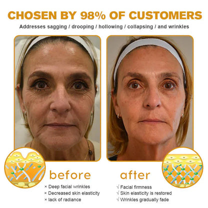 👨‍⚕️ Made and shipped in the DE ✅ Botox Bee Venom Wrinkle Removal Cream – LAST DAY 80% OFF