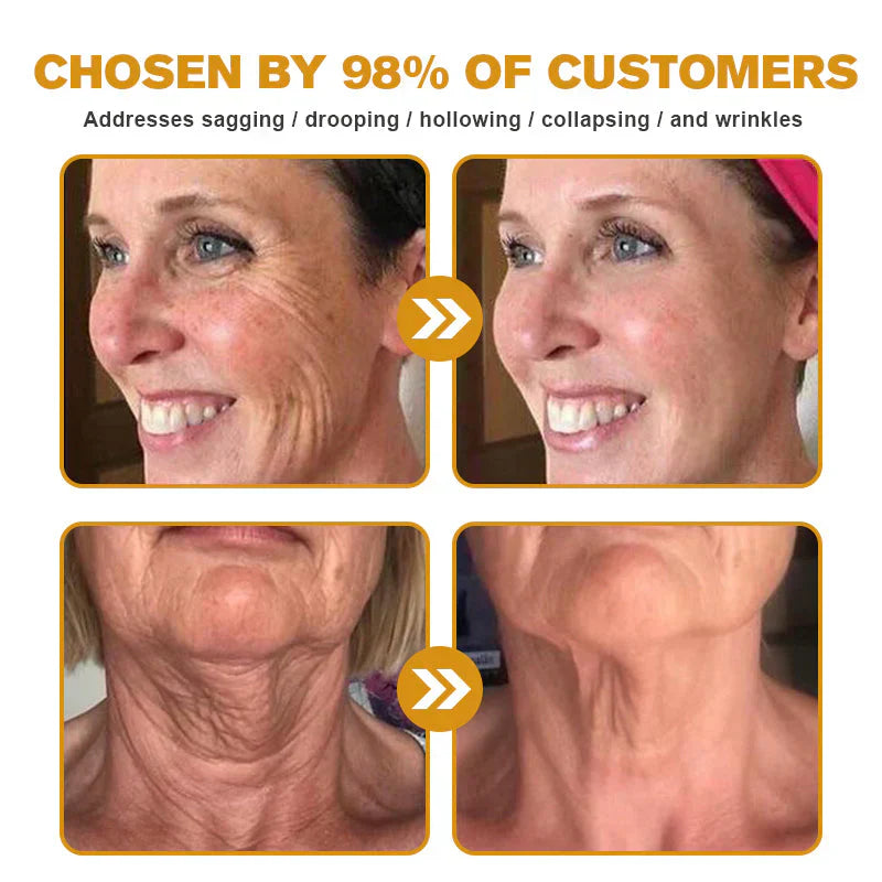 👨‍⚕️ Made and shipped in the DE ✅ Botox Bee Venom Wrinkle Removal Cream – LAST DAY 80% OFF