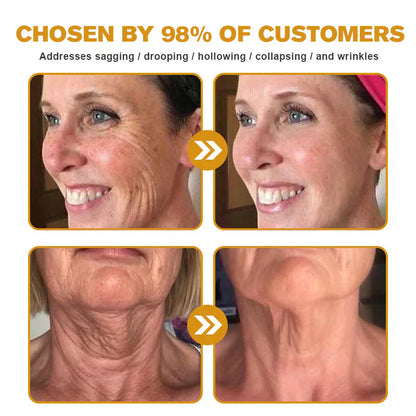 👨‍⚕️ Made and shipped in the DE ✅ Botox Bee Venom Wrinkle Removal Cream – LAST DAY 80% OFF