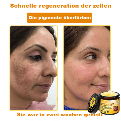 ✨✨Ourlyard® Bee Venom Skin Restoration Cream - 🔥Limited Time 80% OFF🔥