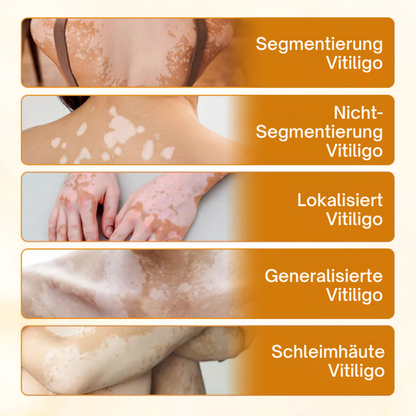 Fivfivgo® VitiCalm Bee Venom Cream, 95% Visible Improvement in 4 Weeks, Promotes Pigmentation &amp; Restores Natural Skin Tone