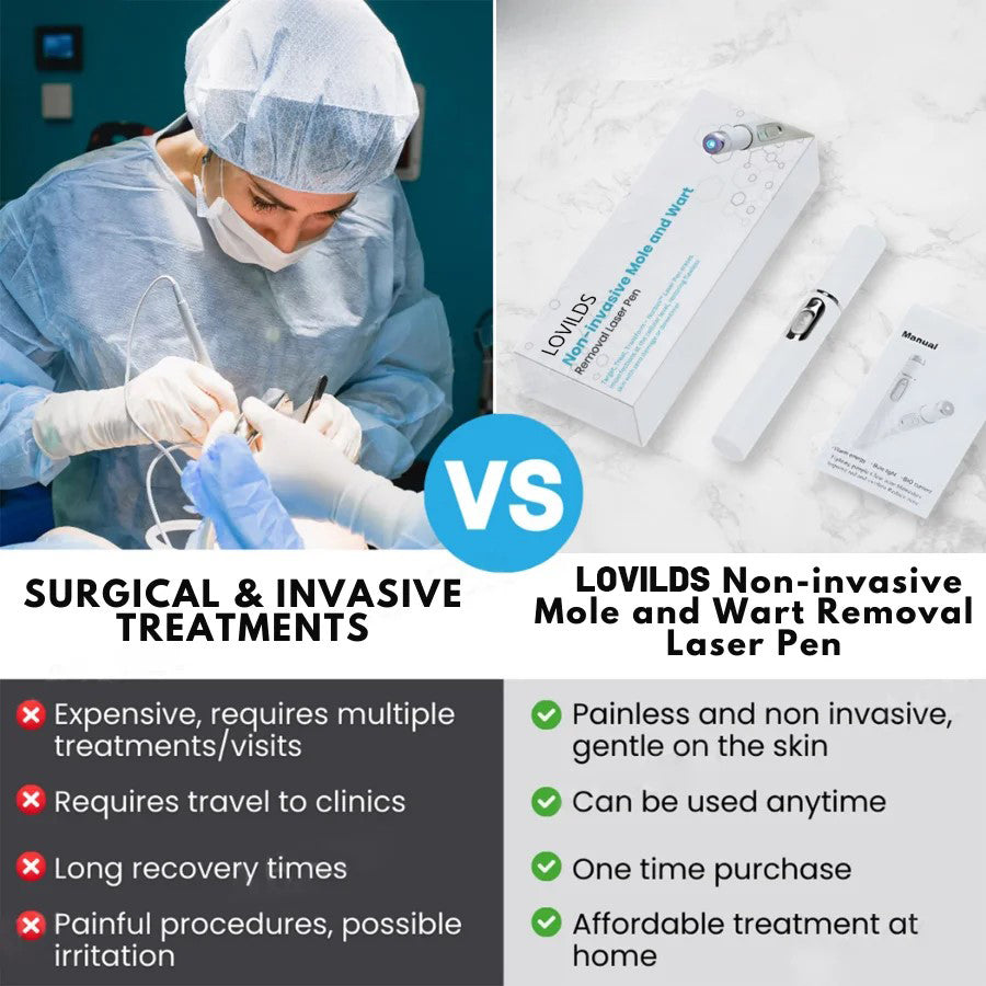 🔥【OFFICIAL STORE】Dougparmo™ Non-Invasive Mole and Wart Removal Laser Pen