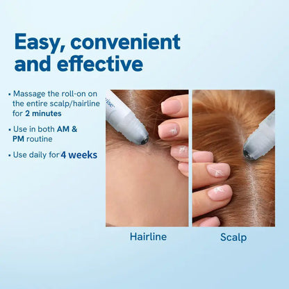 Slimoly™ Professional Anti-Hair Loss Roll-On – Stimulates Hair Growth in 1–2 Weeks