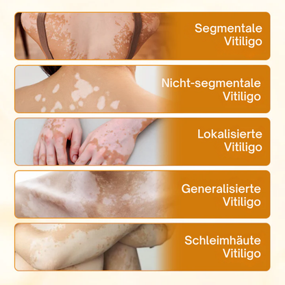Oveallgo® VitiClear Pro Skin Care Cream – 90% effective relief from vitiligo