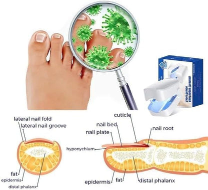 Revolutionary, highly efficient light therapy device for toenail diseases, light therapy for nail fungus, nail cleaning and care (1 piece) 