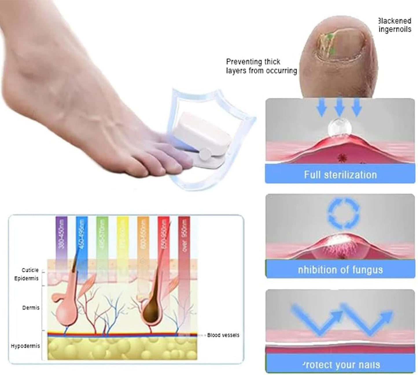 Revolutionary, highly efficient light therapy device for toenail diseases, light therapy for nail fungus, nail cleaning and care (1 piece) 