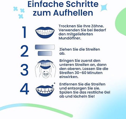 👨‍⚕️Recommended by the IBD✅Professional Teeth Whitening Strips 21 Applications - Enamel Safe - No Sensitivity - Professional Teeth Whitening Strips - 42 Strips + Mouth Opener Included 