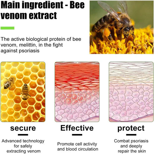 Todahof Bee Venom Psoriasis Treatment Cream, Todahof Bee Venom Psoriasis Treatment Cream, Todahof Bee Venom Cream, Psoriasis Cream, Bee Venom Psoriasis Treatment Cream (3 Pieces)