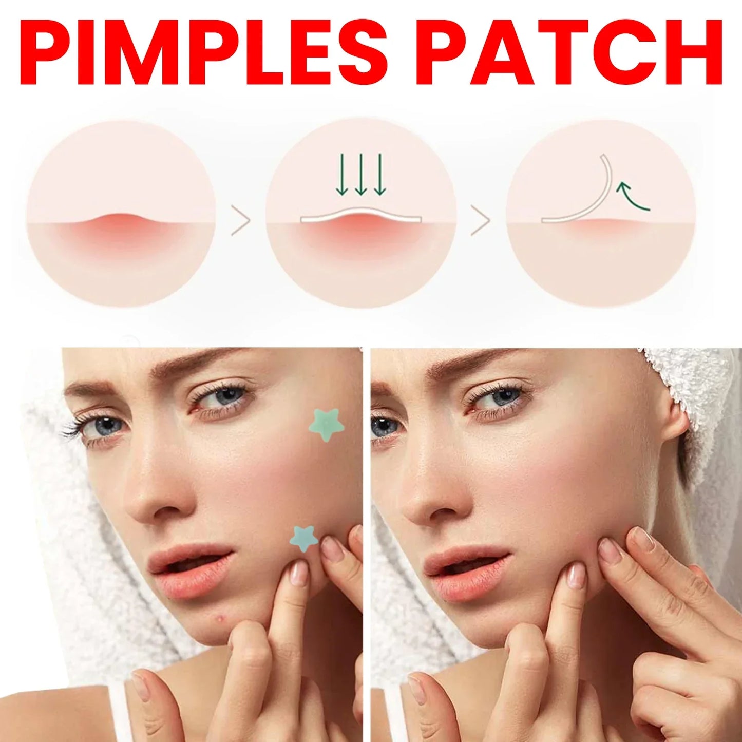 QUSTERE pimple patches for the face, hydrocolloid acne patches 