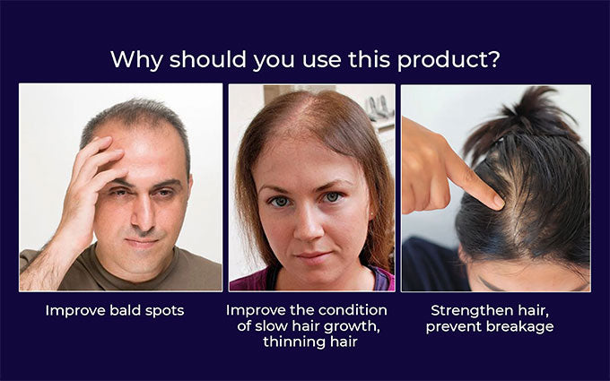 🌿LAST DAY OFFER – 50% OFF🌿 HZA™ Natural Hair Growth Spray 