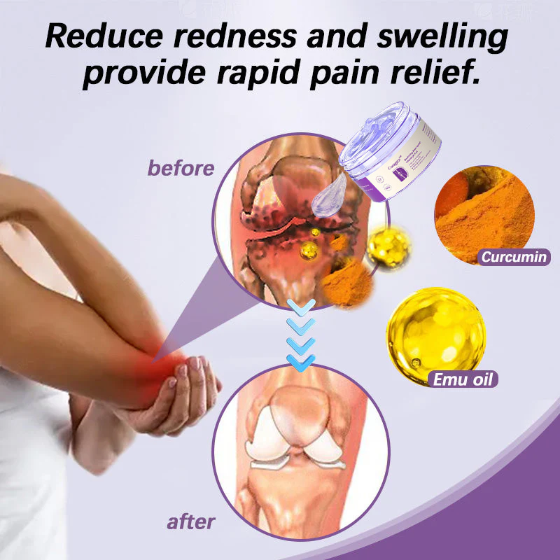 👩‍⚕️Cougex™ Turmeric &amp; Emu Oil Arthritis Soothing Pain Relief Massage Gel 👨‍⚕️Australian Osteopathic Association （AOA）Approved