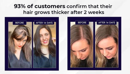🌿LAST DAY OFFER – 50% OFF🌿 HZA™ Natural Hair Growth Spray 