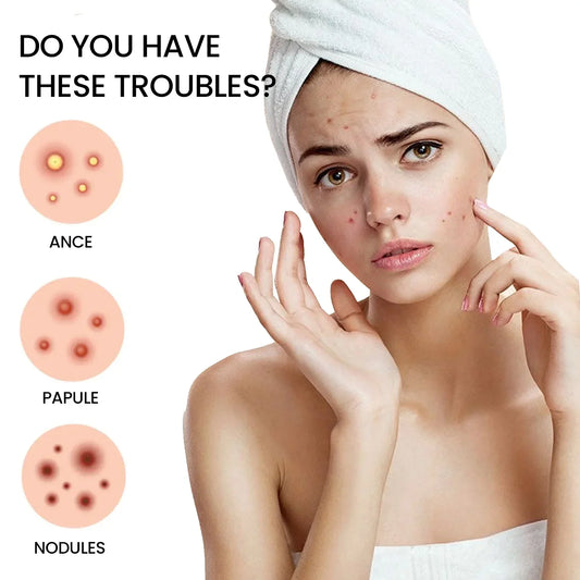 QUSTERE pimple patches for the face, hydrocolloid acne patches 