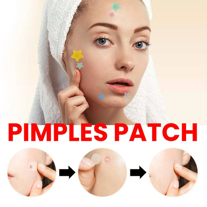 QUSTERE pimple patches for the face, hydrocolloid acne patches 