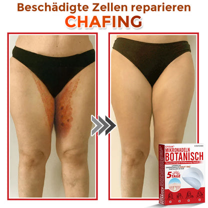 GFOUK® Microneedling Botanical Skin Tag Removal Patch 🇩🇪 Made in Germany
