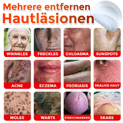 GFOUK® Microneedling Botanical Skin Tag Removal Patch 🇩🇪 Made in Germany