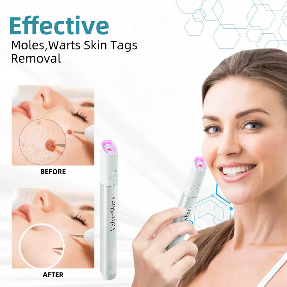 🇨🇦Bikenda® VelvetSkin+ All-in-One Laser Eraser Pen(Powered by CO₂ laser technology – effectively removes moles, warts, skin tags, pigmentation spots, and other skin imperfections)