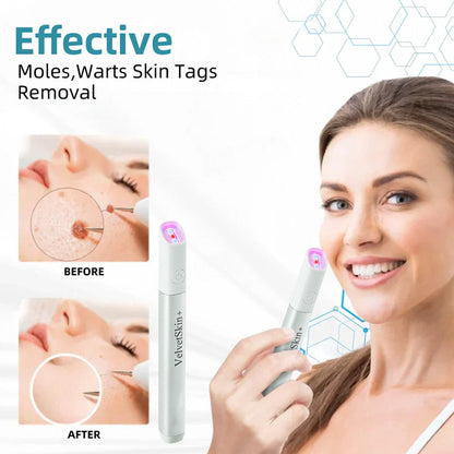 🇨🇦Bikenda® VelvetSkin+ All-in-One Laser Eraser Pen(Powered by CO₂ laser technology – effectively removes moles, warts, skin tags, pigmentation spots, and other skin imperfections)