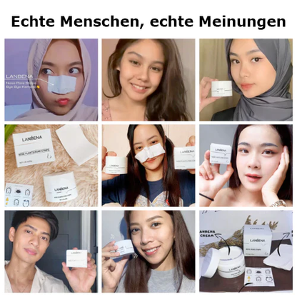 🔥High demand🔥 LANB́ENA™ BLACKHEAD REMOVER