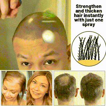 🌿LAST DAY OFFER – 50% OFF🌿 HZA™ Natural Hair Growth Spray 