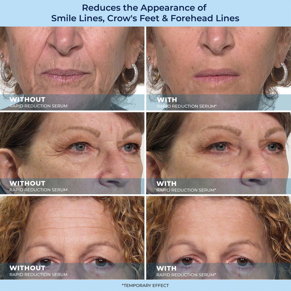 🔥Last day sale: 49% off LBMLBM-HOYGI™ 60-Second Anti-Aging Serum for Wrinkles, Under-Eye Bags, and Dark Circles 