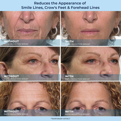🔥Last day sale: 49% off LBMLBM-HOYGI™ 60-Second Anti-Aging Serum for Wrinkles, Under-Eye Bags, and Dark Circles 