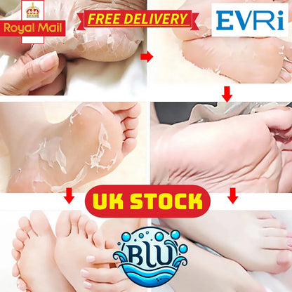 Natural Honey+VitE Foot Care, Kills Athlete's Foot, Removes Dead Skin Cells and Makes Feet as Soft as Baby Feet 