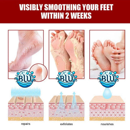 Natural Honey+VitE Foot Care, Kills Athlete's Foot, Removes Dead Skin Cells and Makes Feet as Soft as Baby Feet 
