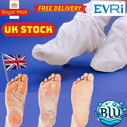 Natural Honey+VitE Foot Care, Kills Athlete's Foot, Removes Dead Skin Cells and Makes Feet as Soft as Baby Feet 
